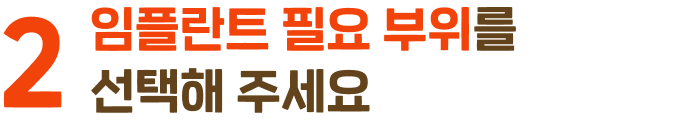 1. 임플란트가 필요한 부위를 선택해 주세요.