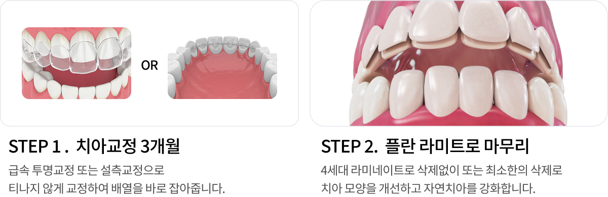 치료 과정 1단계